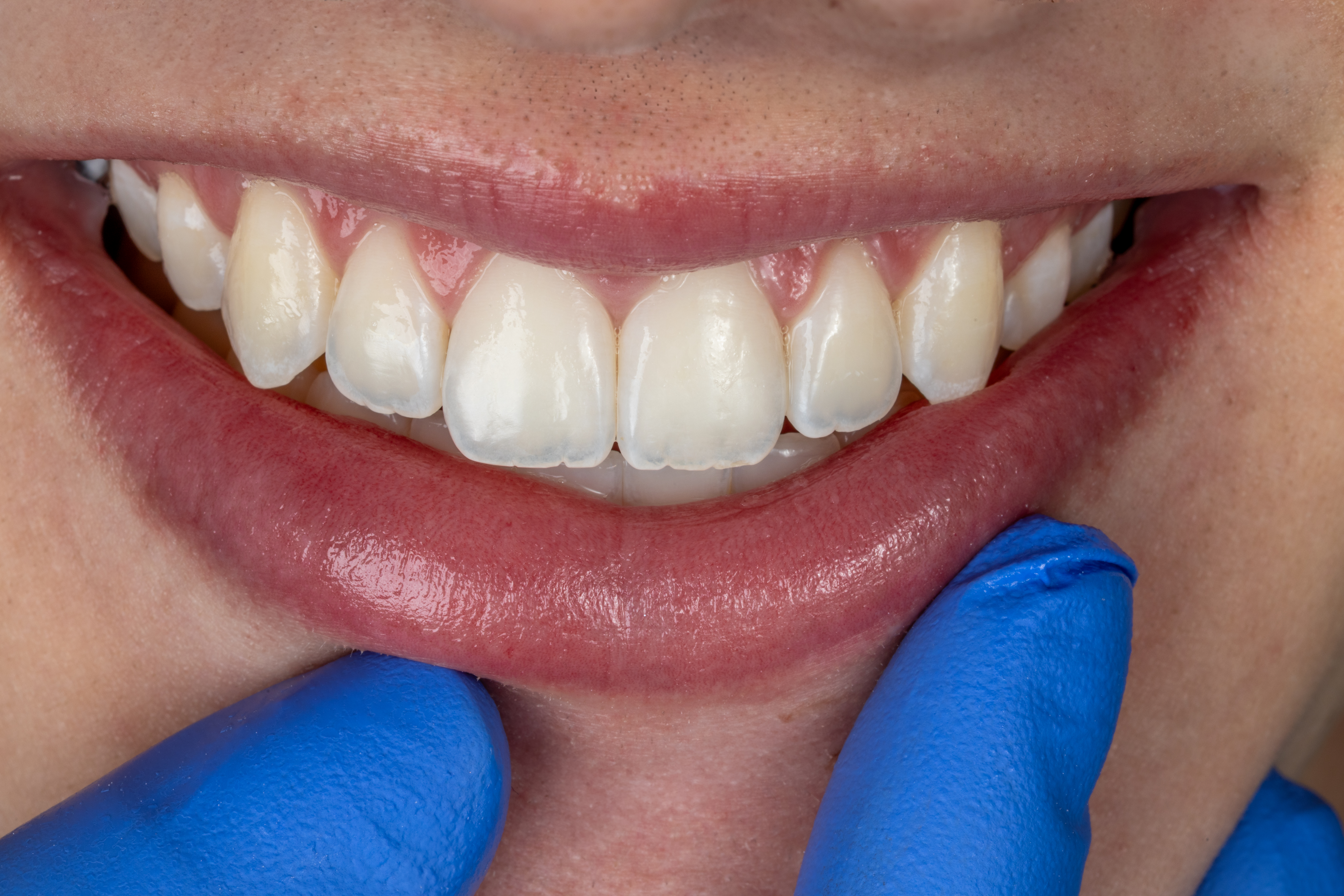 Instalaciones Injoe Dental